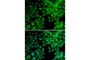 Immunofluorescence analysis of A549 cell using VDR antibody. (Vitamin D Receptor 抗体  (AA 1-300))