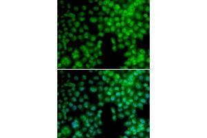 Immunofluorescence analysis of A549 cell using VDR antibody. (Vitamin D Receptor 抗体  (AA 1-300))