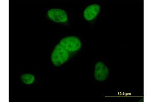 Immunofluorescence of purified MaxPab antibody to ARS2 on HeLa cell. (SRRT 抗体  (AA 1-796))