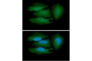ICC/IF analysis of BRCC36 in HeLa cells line, stained with DAPI (Blue) for nucleus staining and monoclonal anti-human BRCC36 antibody (1:100) with goat anti-mouse IgG-Alexa fluor 488 conjugate (Green). (BRCC3 抗体  (AA 1-316))