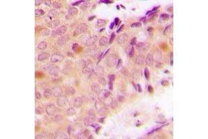 Immunohistochemistry (IHC) image for anti-Poly(rC) Binding Protein 2 (PCBP2) antibody (ABIN7308138) (PCBP2 抗体)
