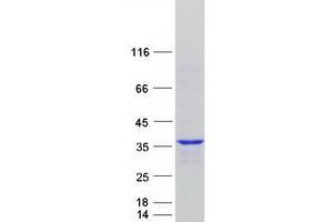 Western Blotting (WB) image for Cyclin Y (CCNY) (Transcript Variant 2) protein (Myc-DYKDDDDK Tag) (ABIN2713327)