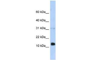 WB Suggested Anti-REG1B Antibody Titration:  0. (REG1B 抗体  (N-Term))