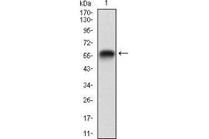 Western blot analysis using RAP1GAP mAb against human RAP1GAP (AA: 412-678) recombinant protein. (RAP1GAP 抗体  (AA 412-678))