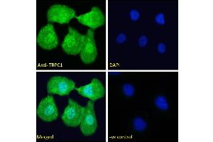 ABIN6391351 Immunofluorescence analysis of paraformaldehyde fixed U2OS cells, permeabilized with 0. (TRPC1 抗体  (Internal Region))