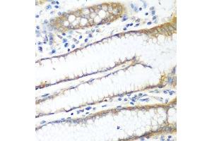 Immunohistochemistry of paraffin-embedded human stomach using PPP4R1 antibody. (PPP4R1 抗体  (AA 324-647))