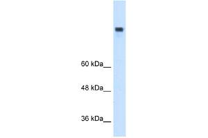 WB Suggested Anti-MTTP Antibody Titration:  0.