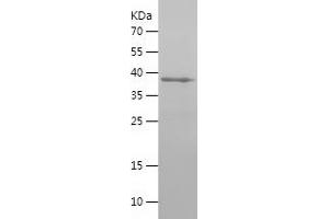 Western Blotting (WB) image for Doublecortin-Like Kinase 1 (DCLK1) (AA 586-740) protein (His-IF2DI Tag) (ABIN7122703) (DCLK1 Protein (AA 586-740) (His-IF2DI Tag))