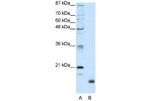 RPL32 antibody used at 2. (RPL32 抗体  (N-Term))