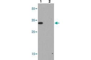 Western blot analysis of RILP in A-20 cell lysate with RILP polyclonal antibody  at 1 ug/mL. (RILP 抗体  (Internal Region))