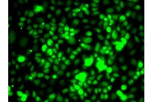 Immunofluorescence analysis of MCF7 cells using TCEB3 antibody (ABIN6131620, ABIN6148938, ABIN6148939 and ABIN6222760). (TCEB3 抗体  (AA 679-798))