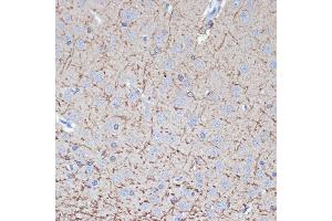 Immunohistochemistry of paraffin-embedded rat brain using TMOD2 Rabbit mAb (ABIN7271011) at dilution of 1:100 (40x lens). (TMOD2 抗体)