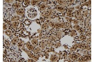 ABIN6277780 at 1/100 staining Rat kidney tissue by IHC-P. (PKC epsilon 抗体  (pSer729))