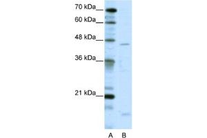 Western Blotting (WB) image for anti-Thyroid Hormone Receptor Interactor 13 (TRIP13) antibody (ABIN2461719) (TRIP13 抗体)