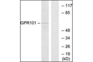 Western blot analysis of extracts from COS7 cells, using GPR101 Antibody. (GPR101 抗体  (C-Term))