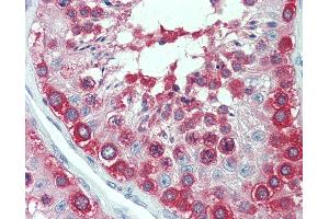 Anti-TCP1 antibody IHC staining of human testis. (TCP1 alpha/CCTA 抗体  (AA 1-557))