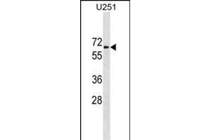 GGT1 Antibody (N-term) (ABIN1881373 and ABIN2838799) western blot analysis in  cell line lysates (35 μg/lane). (GGT1 抗体  (N-Term))