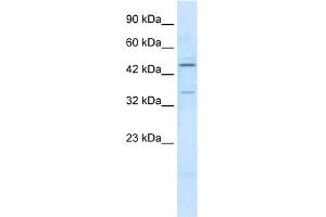 WB Suggested Anti-ZNF358 Antibody Titration:  1. (ZNF358 抗体  (N-Term))