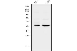 Western blot analysis of CXCR2 using anti-CXCR2 antibody (ABIN7601315).