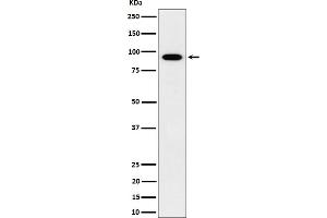 Western blot analysis of IFT88 expression in HepG2 cell lysate.