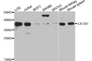 Western blot analysis of extracts of various cell lines, using EIF2S1 antibody. (EIF2S1 抗体)