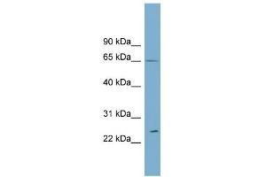 WB Suggested Anti-RPN2 Antibody Titration:  0. (Ribophorin II 抗体  (Middle Region))