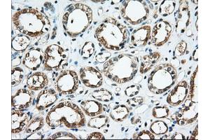 Immunohistochemical staining of paraffin-embedded Human Kidney tissue using anti-KHK mouse monoclonal antibody. (Ketohexokinase 抗体)
