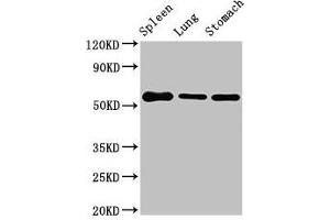 Western Blot Positive WB detected in: Mouse spleen tissue, Mouse lung tissue, Mouse stomach tissue All lanes: Glp1r antibody at 3 μg/mL Secondary Goat polyclonal to rabbit IgG at 1/50000 dilution Predicted band size: 54 kDa Observed band size: 54 kDa (GLP1R 抗体  (AA 22-145))
