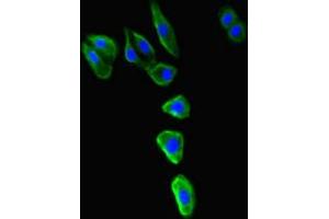 Immunofluorescence analysis of HepG2 cells, using MR1 antibody (1/100 dilution) and AF488-conjugated Goat anti-Rabbit IgG (H+L) secondary antibody. (MR1 抗体  (AA 150-253))