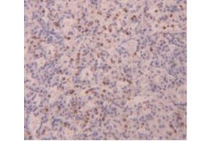 IHC-P analysis of Human Spleen Tissue, with DAB staining. (FLG2 抗体  (AA 1222-1368))