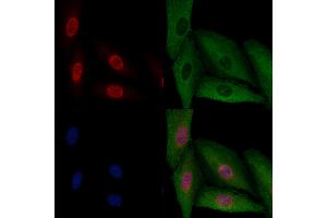 ABIN6256914 and ABIN6274189 staining  cells by IF/ICC.