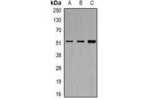 Western blot analysis of eIF3E expression in MCF7 (A), K562 (B), HepG2 (C) whole cell lysates. (EIF3E 抗体)