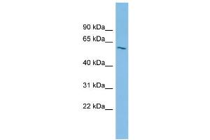 WB Suggested Anti-IPPK Antibody Titration: 0.