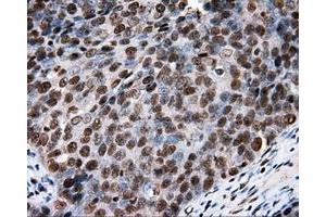 Immunohistochemical staining of paraffin-embedded colon tissue using anti-RC204952 mouse monoclonal antibody.