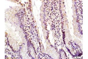 Formalin-fixed and paraffin embedded rat small intestine labeled with Anti-Egr1 Polyclonal Antibody, Unconjugated  at 1:200 followed by conjugation to the secondary antibody and DAB staining. (EGR1 抗体  (AA 401-453))