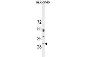 CF062 Antibody (Center) western blot analysis in mouse kidney tissue lysates (35µg/lane). (C6ORF62 抗体  (Middle Region))