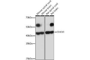 Western blot analysis of extracts of various cell lines, using CHX10 Rabbit mAb (ABIN7271331) at 1:1000 dilution. (VSX2 抗体)