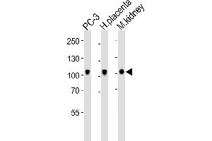 Western blot analysis of lysates from PC-3 cell line, human placenta, mouse kidney tissue lysate (from left to right), using Ephb4 Antibody (C-term) (ABIN6243858 and ABIN6577663). (EPH Receptor B4 抗体  (C-Term))