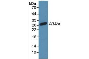 Detection of Recombinant RANk, Rat using Polyclonal Antibody to Receptor Activator Of Nuclear Factor Kappa B (RANk) (TNFRSF11A 抗体  (AA 31-214))