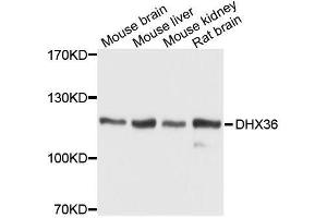 Western blot analysis of extracts of various cell lines, using DHX36 antibody. (DHX36 抗体  (AA 1-260))