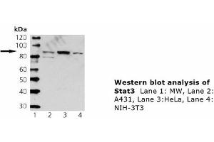 Image no. 1 for anti-Signal Transducer and Activator of Transcription 3 (Acute-Phase Response Factor) (STAT3) antibody (ABIN331480) (STAT3 抗体)