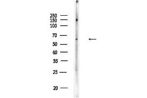 anti-Coiled-Coil Domain Containing 8 (CCDC8) (N-Term) antibody
