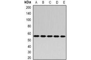 Western blot analysis of RABIN3 expression in Hela (A), A549 (B), mouse kidney (C), mouse liver (D), rat brain (E) whole cell lysates. (RAB3IP 抗体)