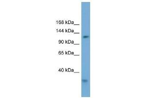 Western Blot showing RFC1 antibody used at a concentration of 1-2 ug/ml to detect its target protein. (RFC1 抗体  (Middle Region))