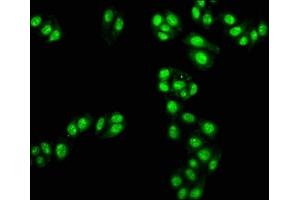 Immunofluorescence staining of HepG2 cells with ABIN7171330 at 1:100, counter-stained with DAPI. (TAL1 抗体  (AA 1-114))