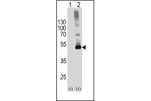 Western blot analysis of SPHK1-M1 Antibody (arrow) using rabbit polyclonal SPHK1-M1 Antibody (ABIN391345 and ABIN2841366). (SPHK1 抗体  (N-Term))
