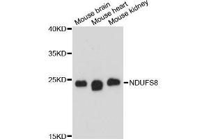 Western blot analysis of extracts of various cell lines, using NDUFS8 antibody. (NDUFS8 抗体  (AA 35-210))