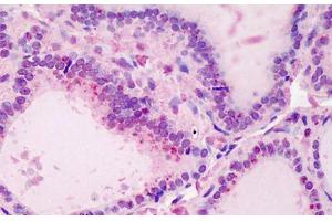 Human Thyroid: Formalin-Fixed, Paraffin-Embedded (FFPE) (UBE2N 抗体  (AA 40-51))