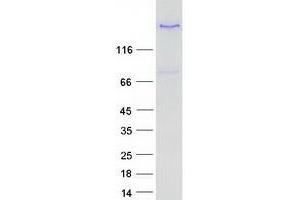 LTBP3 Protein (Transcript Variant 1) (Myc-DYKDDDDK Tag)