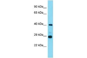Host: Rabbit  Target Name: Lhfpl3  Sample Tissue: Mouse Heart lysates  Antibody Dilution: 1. (LHFPL3 抗体  (C-Term))